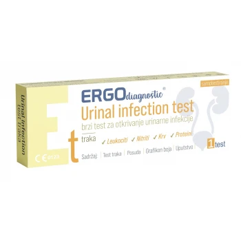 Ergo Diagnostic test na urinarnu infekciju